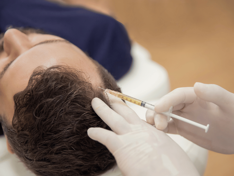 Hair Restoration Treatments