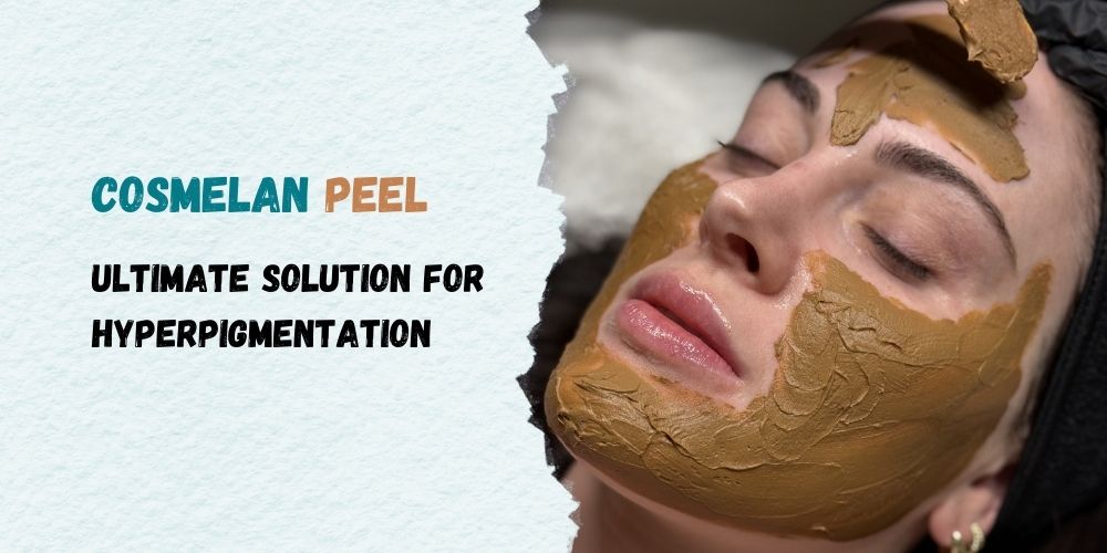 Cosmelan Peel