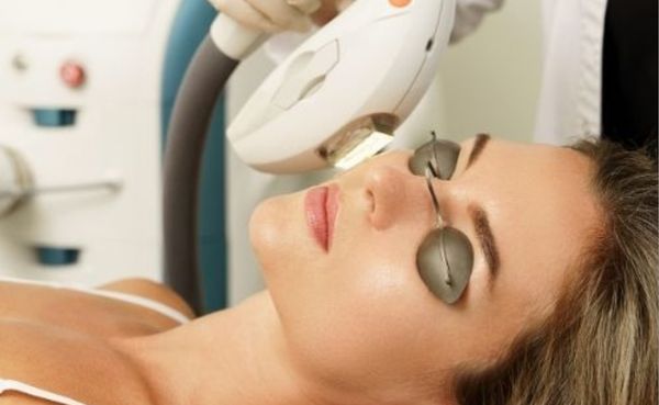 IPL Photofacial