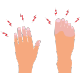 Constantly damp palms or feet