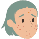 Hormonal Changes