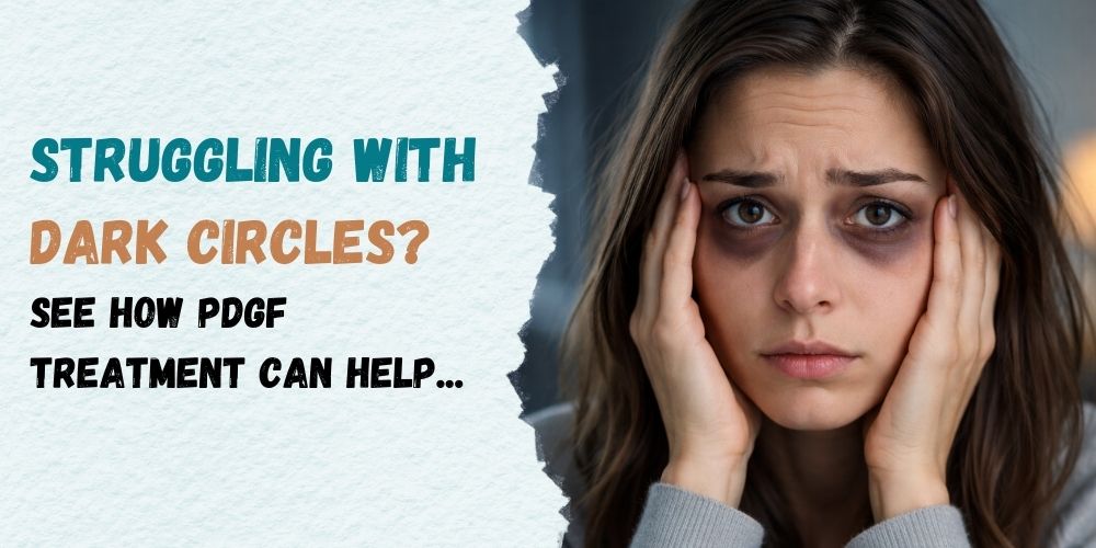 How PDGF Treatments Help Reduce Dark Circles Under the Eyes