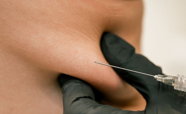 kyBella