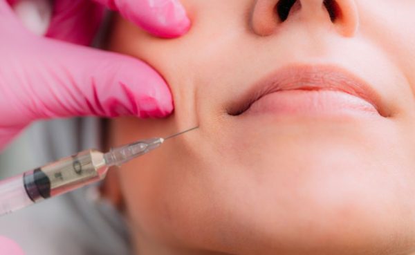 Dermal Fillers